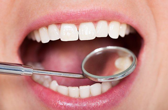 Dentist checking patient's smile after metal free dental restoration