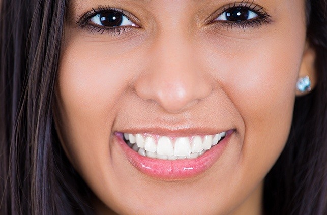 Woman sharing smile after teeth whitening treatment