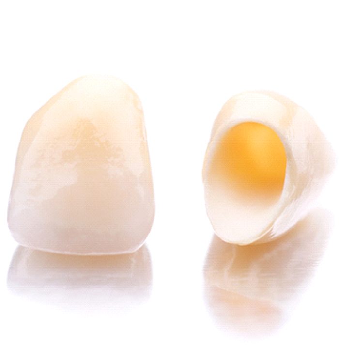 Closeup of two dental crowns in Fitchburg on white background