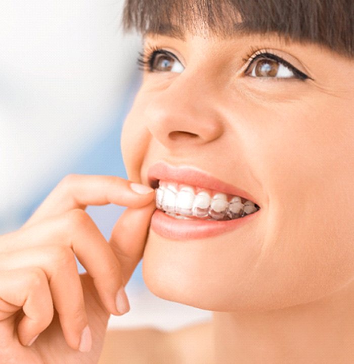 Woman smiling while putting in Invisalign in Fitchburg