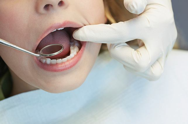 Dentist checking child's dental sealants