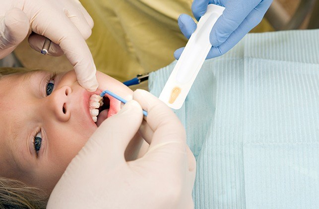 Child receiving fluoride treatment