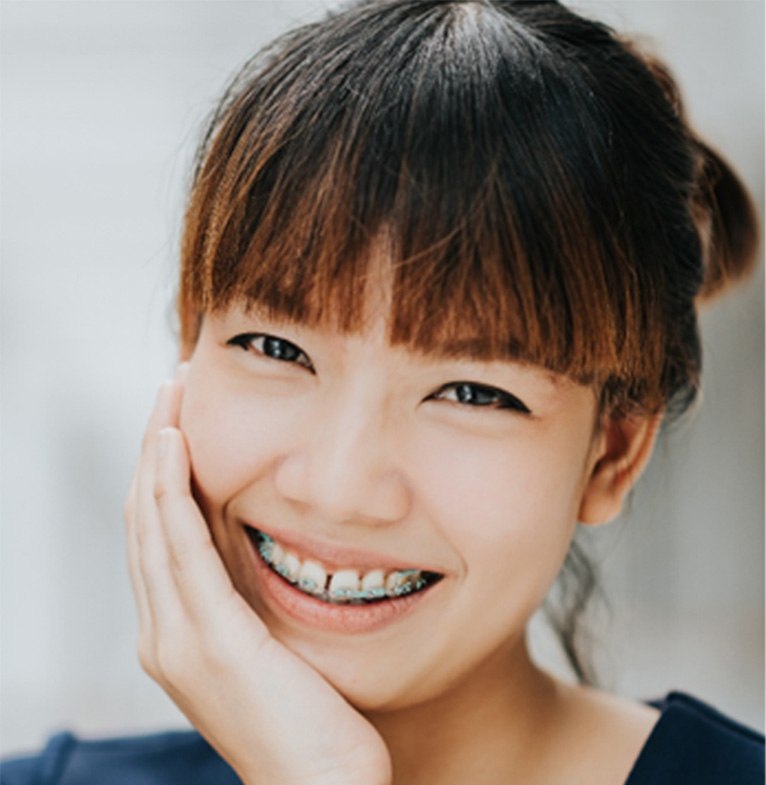 Closeup of woman smiling with traditional braces in Fitchburg