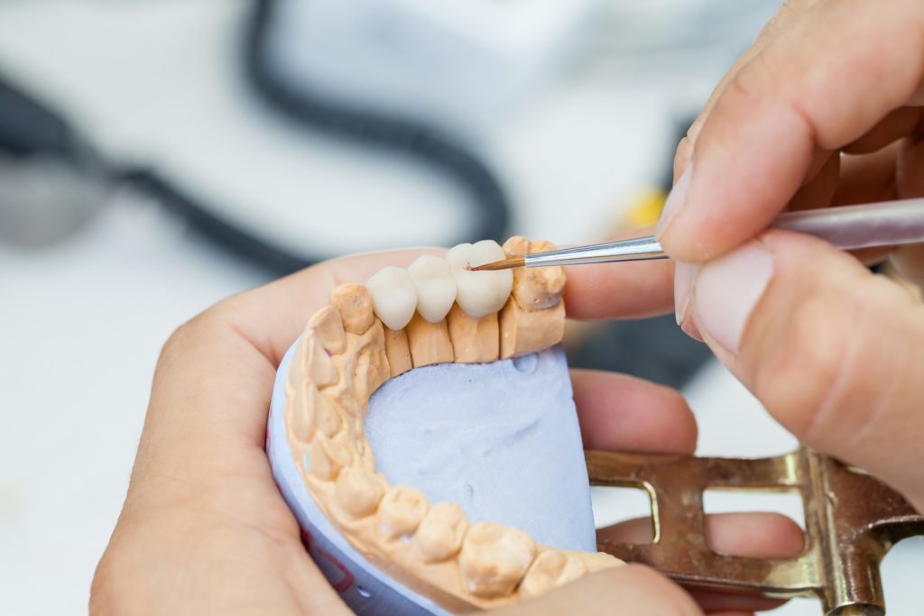 Lab artisan making dental bridge