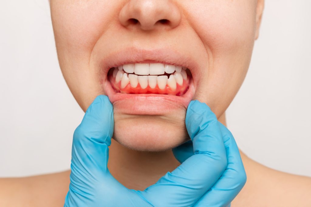 Dentist examining woman's teeth and gums